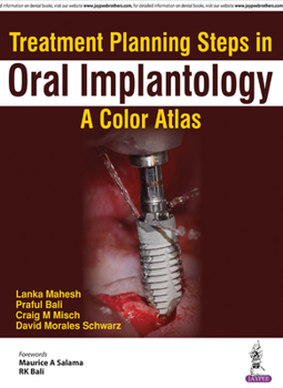 Paperback Treatment Planning Steps in Oral Implantology: A Color Atlas Book