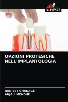 Paperback Opzioni Protesiche Nell'implantologia [Italian] Book