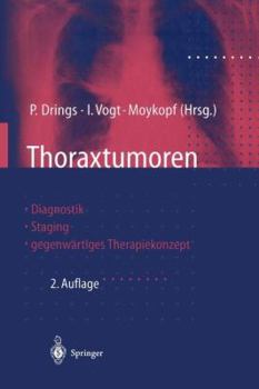 Paperback Thoraxtumoren: Diagnostik -- Staging -- Gegenwärtiges Therapiekonzept [German] Book