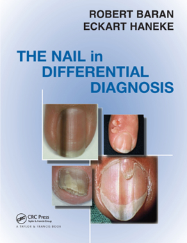 Paperback The Nail in Differential Diagnosis Book