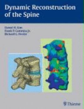 Hardcover Dynamic Reconstruction of the Spine Book