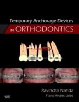 Hardcover Temporary Anchorage Devices in Orthodontics Book