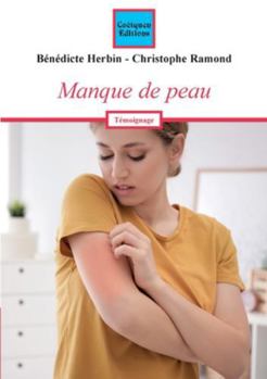 Paperback Manque de peau [French] Book