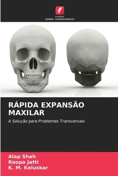 Paperback Rápida Expansão Maxilar [Portuguese] Book