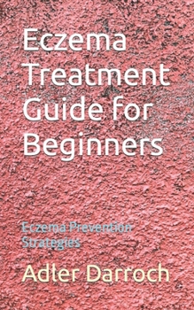 Paperback Eczema Treatment Guide for Beginners: Eczema Prevention Strategies Book