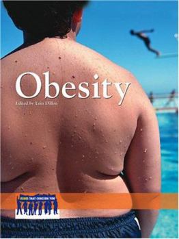 Library Binding Obesity Book