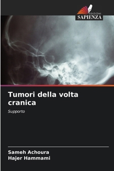 Paperback Tumori della volta cranica [Italian] Book