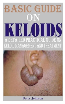 Paperback Basic Guide on Keloids: A detailed practical guide on keloid management and treatment Book