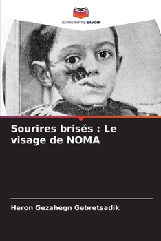 Paperback Sourires brisés: Le visage de NOMA [French] Book
