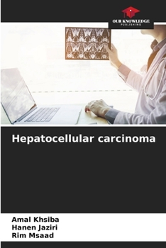 Paperback Hepatocellular carcinoma Book