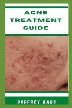Paperback Acne Treatment Guide: Manage acne with ease Book