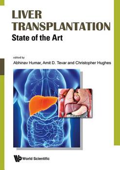 Hardcover Liver Transplantation: State of the Art Book