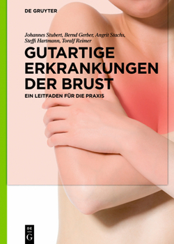 Hardcover Gutartige Erkrankungen Der Brust: Ein Leitfaden Für Die PRAXIS [German] Book