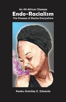 Paperback Endo-Racialism Book