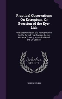 Hardcover Practical Observations On Ectropium, Or Eversion of the Eye-Lids: With the Description of a New Operation for the Cure of That Disease; On the Modes o Book