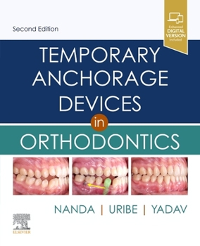 Hardcover Temporary Anchorage Devices in Orthodontics Book