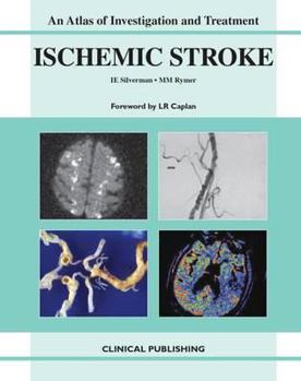 Hardcover Ischemic Stroke: An Atlas of Investigation and Treatment Book