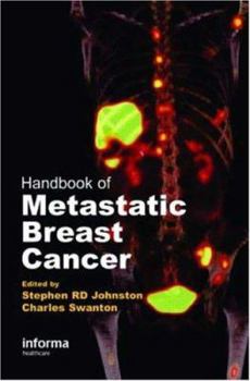 Hardcover Handbook of Metastatic Breast Cancer Book