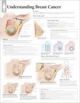 Misc. Understanding Breast Cancer Wall Chart Book