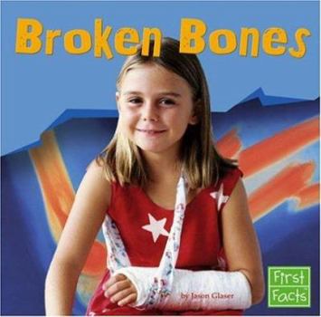 Library Binding Broken Bones Book