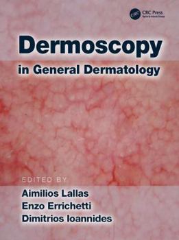 Hardcover Dermoscopy in General Dermatology Book