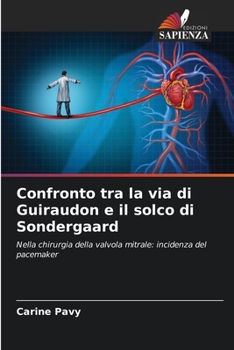 Paperback Confronto tra la via di Guiraudon e il solco di Sondergaard [Italian] Book