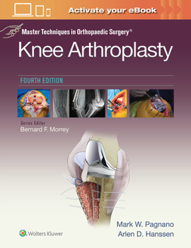 Hardcover Master Techniques in Orthopedic Surgery: Knee Arthroplasty Book