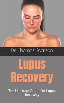 Paperback Lupus Recovery: The Ultimate Guide On Lupus Recovery Book