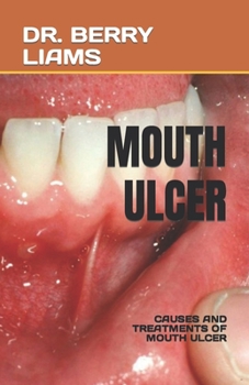 Paperback Mouth Ulcer: Causes and Treatments of Mouth Ulcer Book