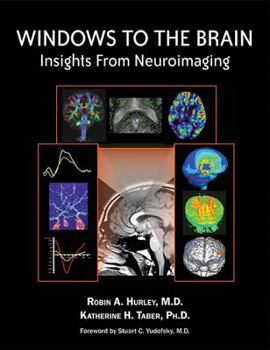 Hardcover Windows to the Brain: Insights from Neuroimaging Book
