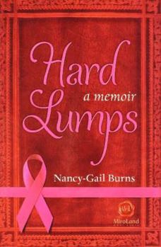 Paperback Hard Lumps: A Memoir Book