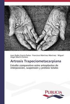Paperback Artrosis Trapeciometacarpiana [Spanish] Book
