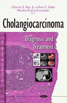 Hardcover Cholangiocarcinoma: Diagnosis and Treatment (Cancer Etiology, Diagnosis and Treatments) Book