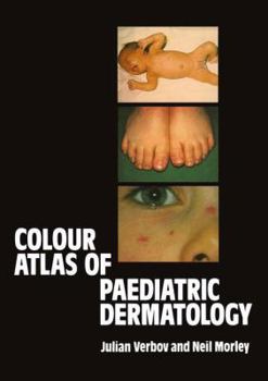 Hardcover Colour Atlas of Paediatric Dermatology Book