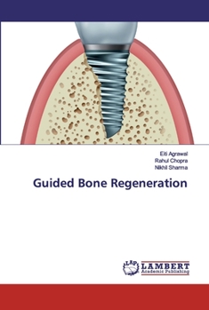 Paperback Guided Bone Regeneration Book