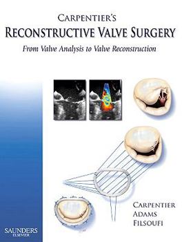 Hardcover Carpentier's Reconstructive Valve Surgery: From Valve Analysis to Valve Reconstruction Book