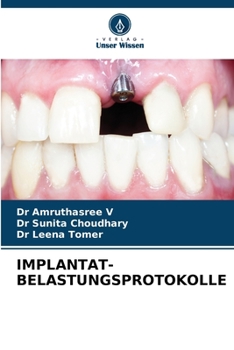 Paperback Implantat-Belastungsprotokolle [German] Book