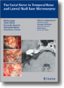 Hardcover The Facial Nerve in Temporal Bone and Lateral Skull Base Microsurgery Book