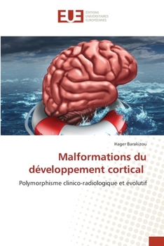 Paperback Malformations du développement cortical [French] Book