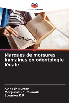 Paperback Marques de morsures humaines en odontologie légale [French] Book