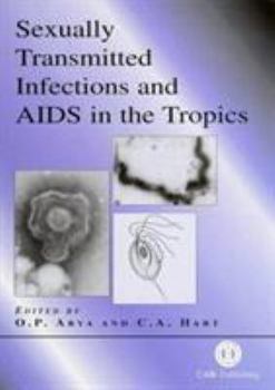 Hardcover Sexually Transmitted Infections and AIDS in the Tropics Book
