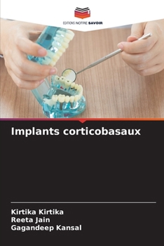 Paperback Implants corticobasaux [French] Book