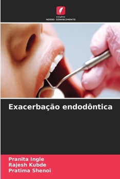 Paperback Exacerbação endodôntica [Portuguese] Book