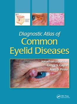 Hardcover Diagnostic Atlas of Common Eyelid Diseases Book