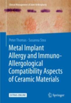 Paperback Metal Implant Allergy and Immuno-Allergological Compatibility Aspects of Ceramic Materials Book