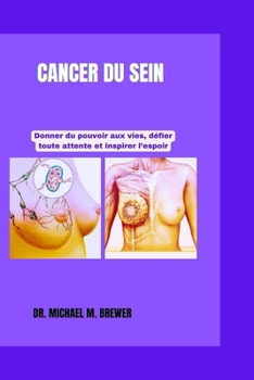 CANCER DU SEIN: Donner du pouvoir aux vies, défier toute attente et inspirer l'espoir (Staying Healthy and Hope for Better Tomorrow Series) (French Edition)