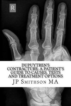 Paperback Dupuytren's Contracture: : A Patient's Guide to Causes, Tests and Treatment Option Book