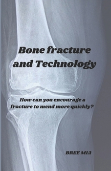 Paperback Bone fracture and Technology: How can you encourage a fracture to mend more quickly? Book