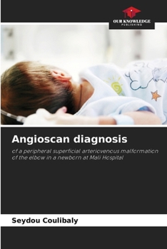 Paperback Angioscan diagnosis Book