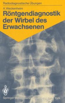 Paperback Röntgendiagnostik Der Wirbel Des Erwachsenen: 125 Diagnostische Übungen Für Studenten Und Praktische Radiologen [German] Book